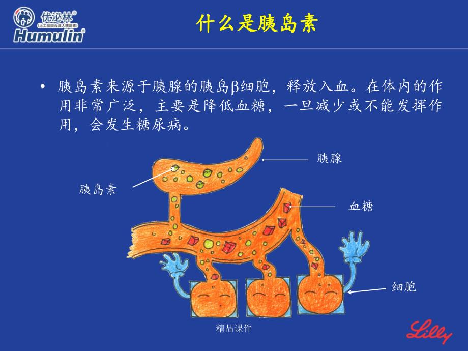 低血糖的原因、症状及处理课件_第4页