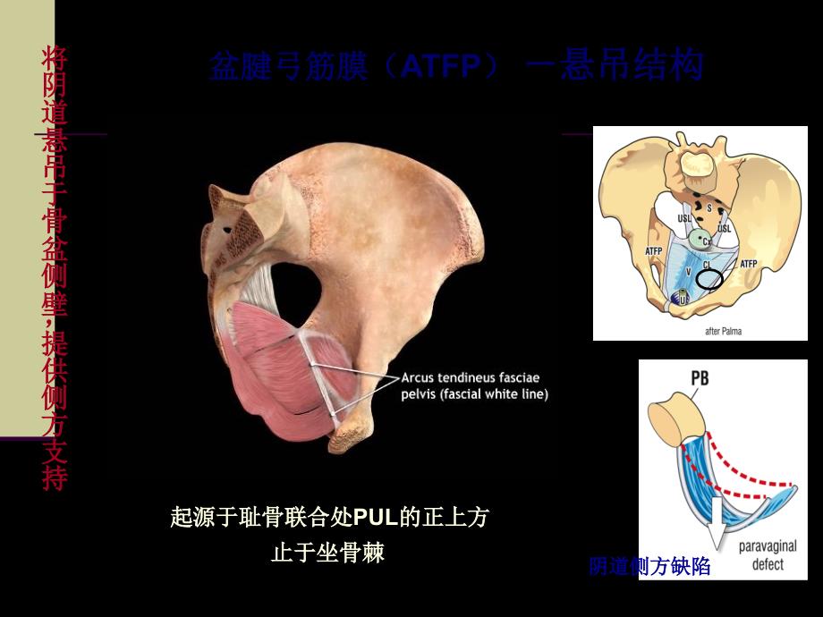 IntegralTheory盆底动力解剖与盆底重建手术课件幻灯PPTPPT文档_第4页