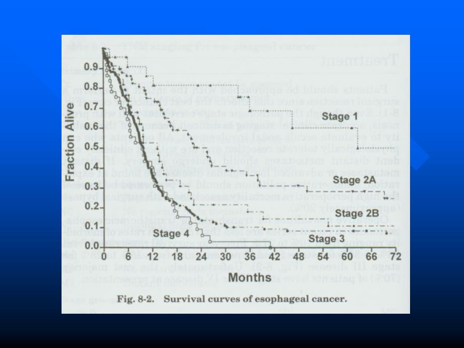 食管癌分期及其手段课件_第4页