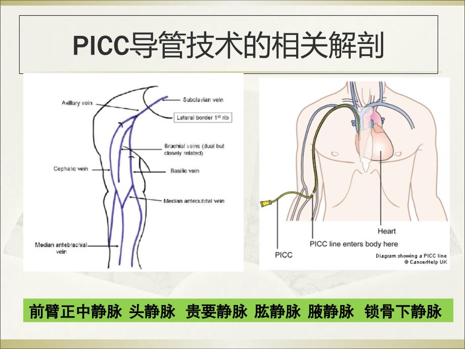 PICC导管头端定位与并发症处理.ppt_第3页