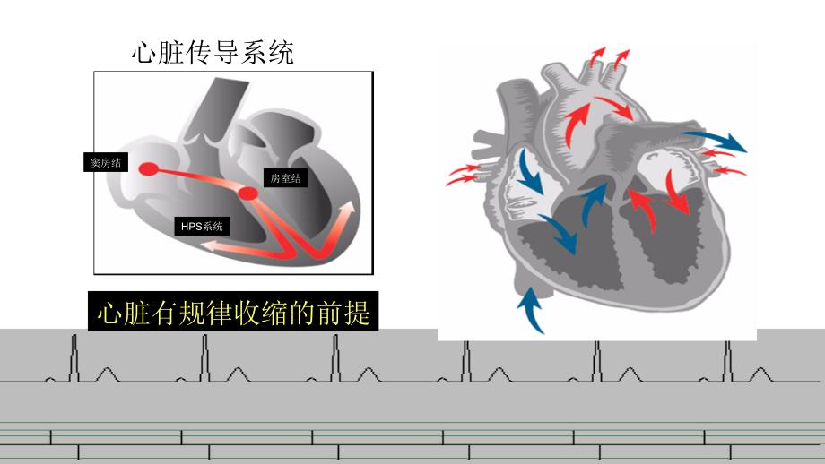 心外科临时起搏器.ppt_第4页