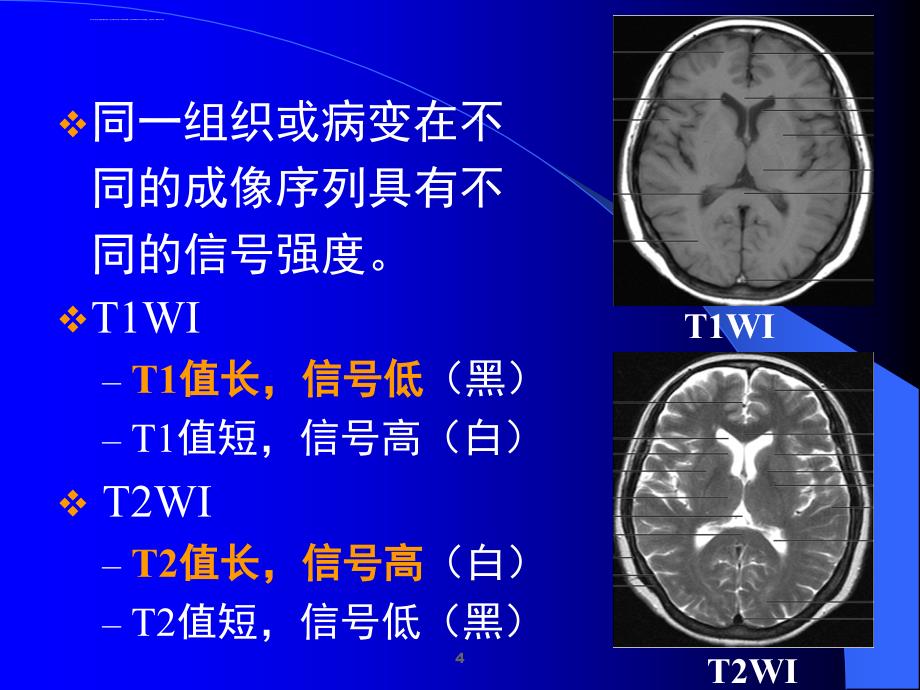 磁共振临床应用及进展ppt课件_第4页