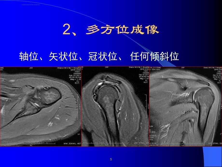 磁共振临床应用及进展ppt课件_第5页