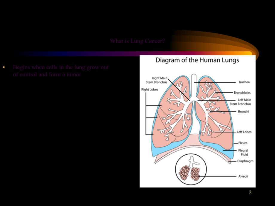 讲课肺癌英文ppt课件_第2页