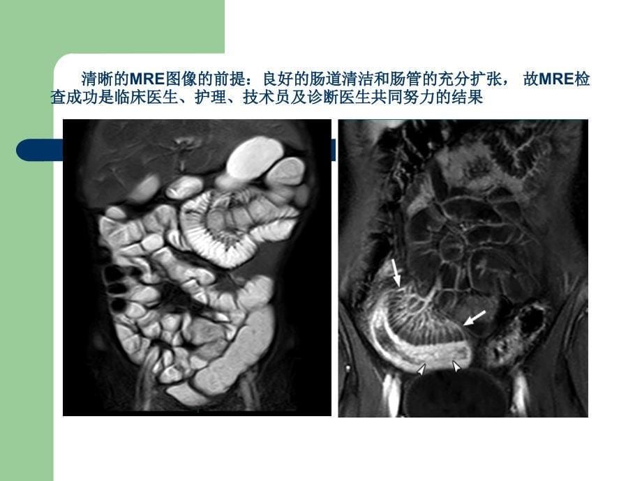 mri在儿童及胎儿疾病诊断中的应用ppt课件_第5页