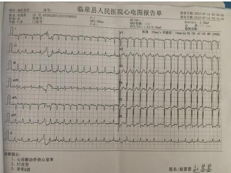 慢性心力衰竭护理查房_第5页