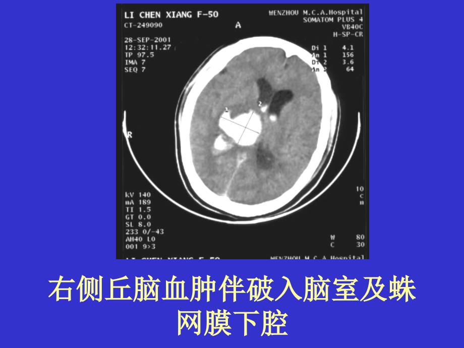 CT-实习片PPT演示课件_第3页