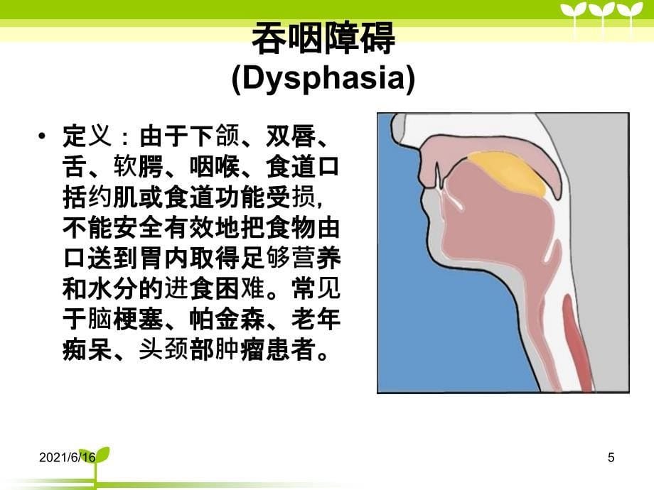 老年人吞咽障碍的评估及护理_第5页