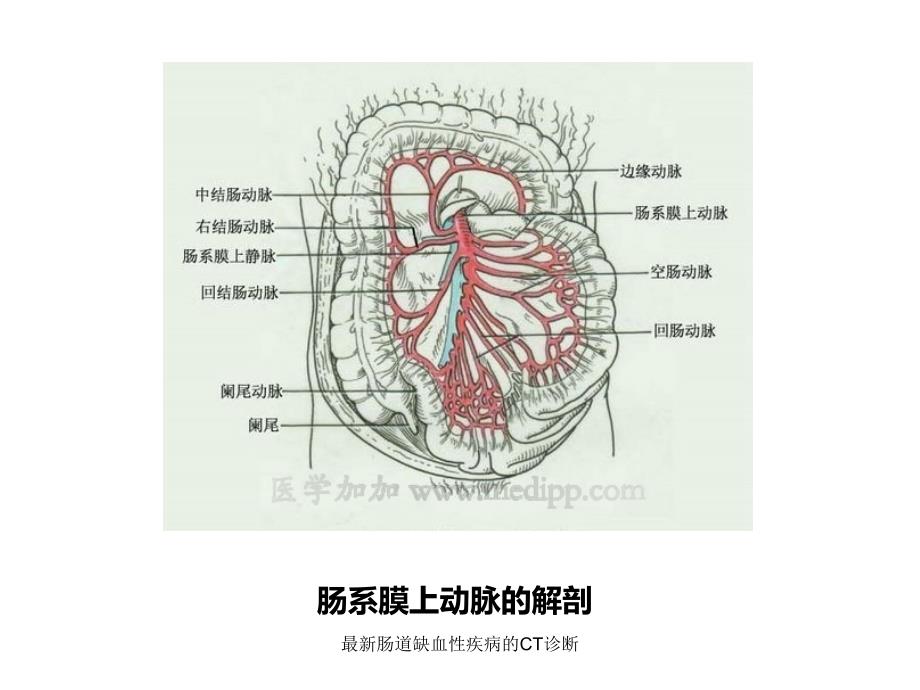 最新肠道缺血性疾病的CT诊断_第3页