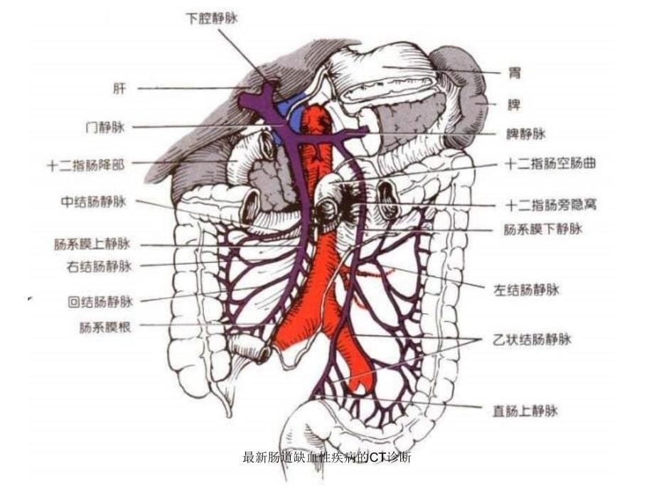 最新肠道缺血性疾病的CT诊断_第5页