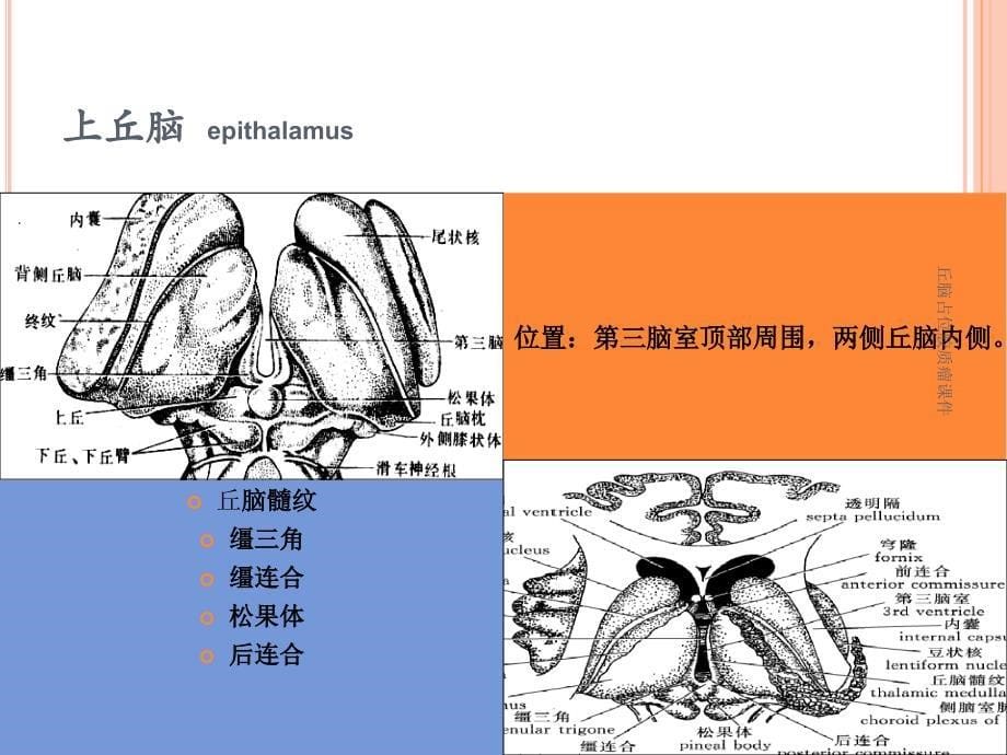 丘脑占位胶质瘤课件_第5页