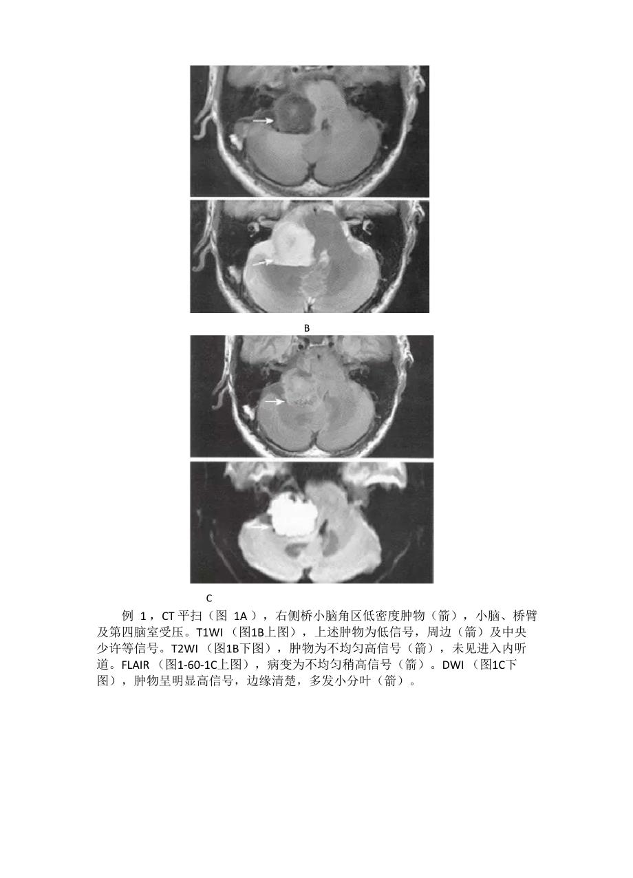 表皮样囊肿病理与临床特点_第3页