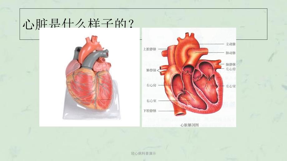 冠心病科普演示课件_第3页