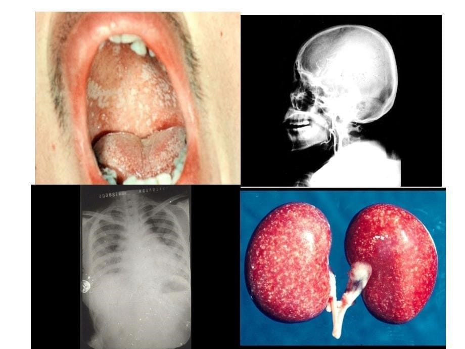 教学课件第36章真菌总论_第5页