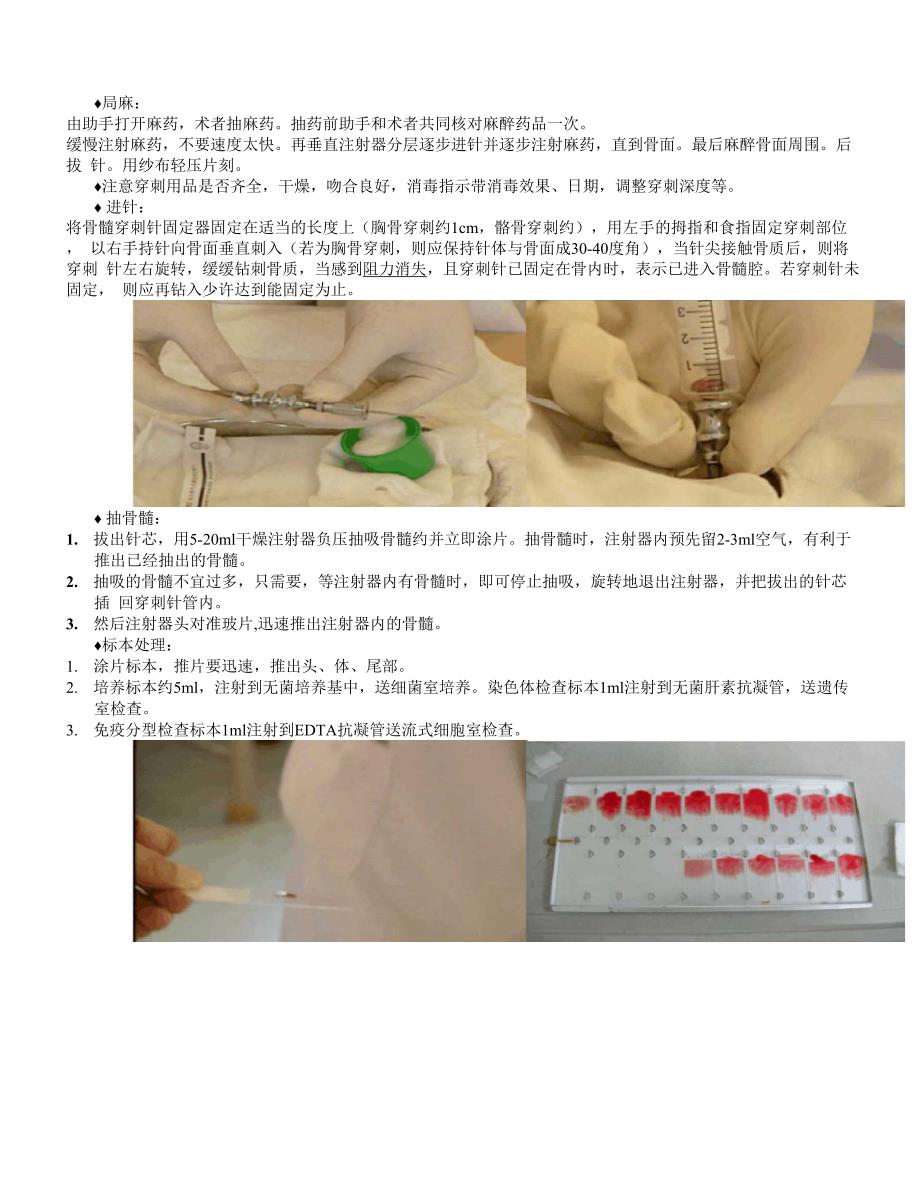 骨髓穿刺术指南_第4页