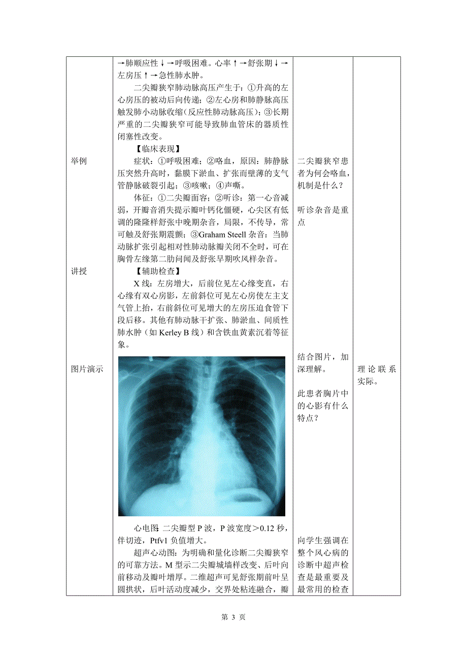 心血管内科(心内科)_见习教案_7_心脏瓣膜病.docx_第3页