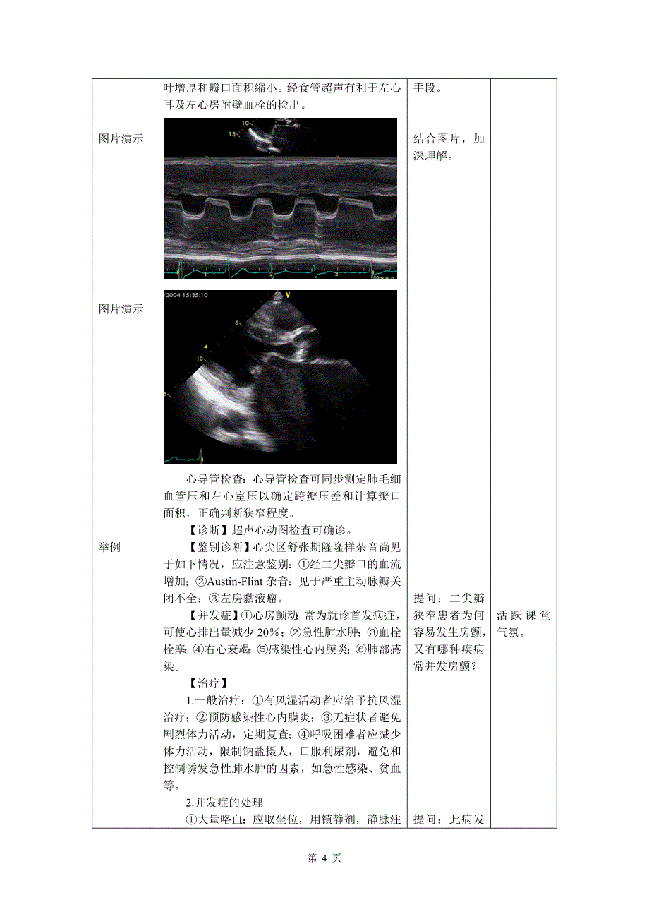 心血管内科(心内科)_见习教案_7_心脏瓣膜病.docx_第4页