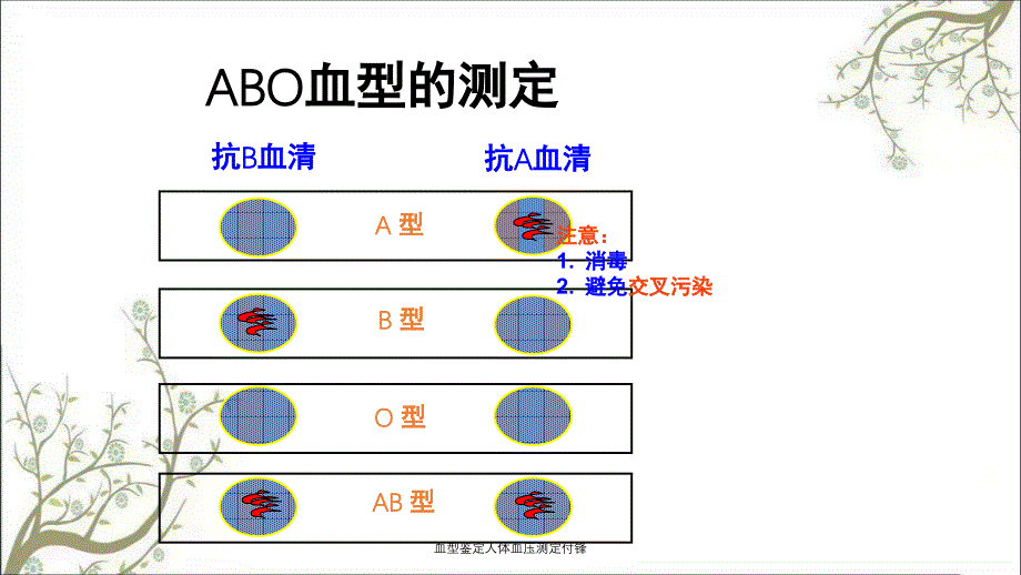 血型鉴定人体血压测定付锋课件_第4页