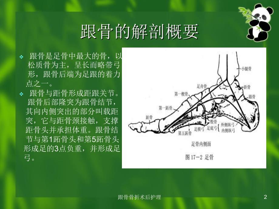 跟骨骨折术后护理课件_第2页