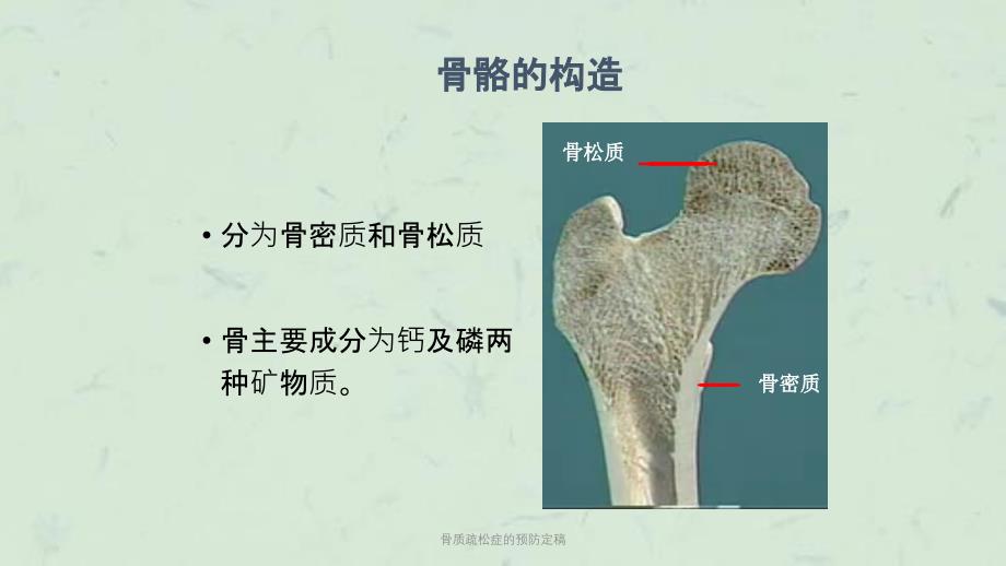 骨质疏松症的预防定稿课件_第4页