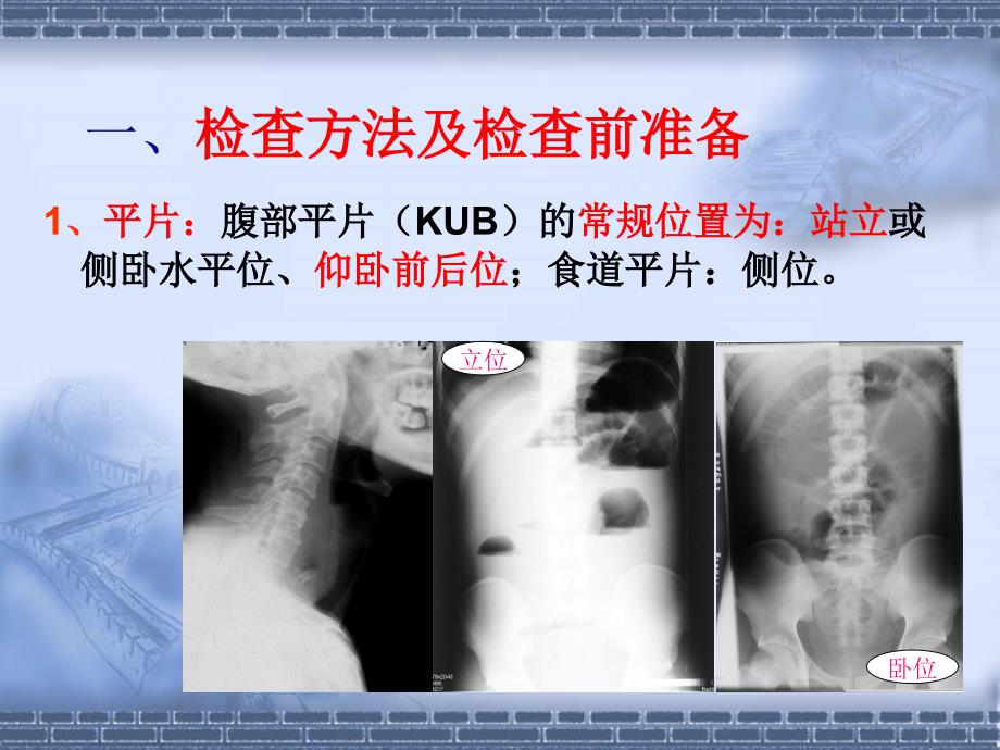 消化道的常用检查_第3页