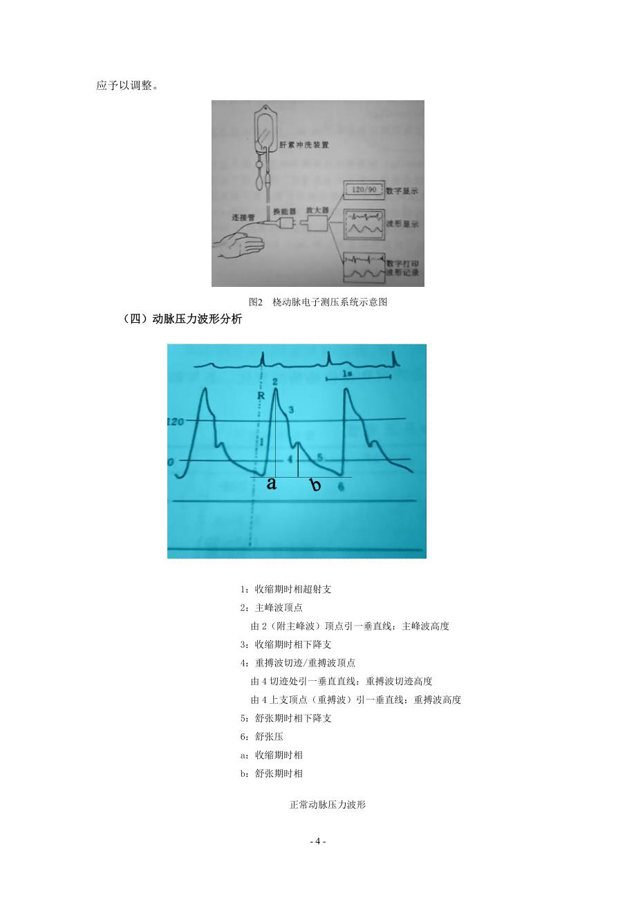 动脉穿刺置管及动脉压测定.doc_第4页