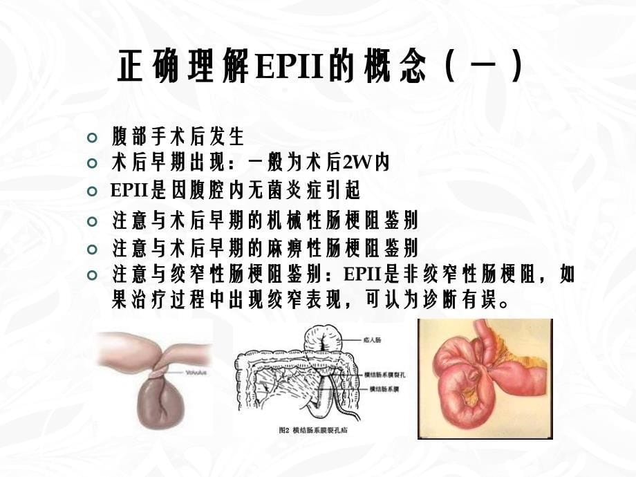 术后早期炎性肠梗阻诊断和治疗_第5页