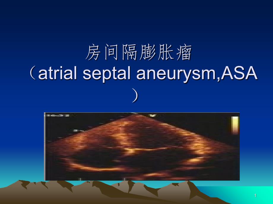 房间隔膨胀瘤PPT精选文档_第1页