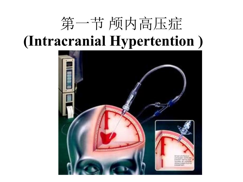 第十八章颅脑损伤课件_第2页