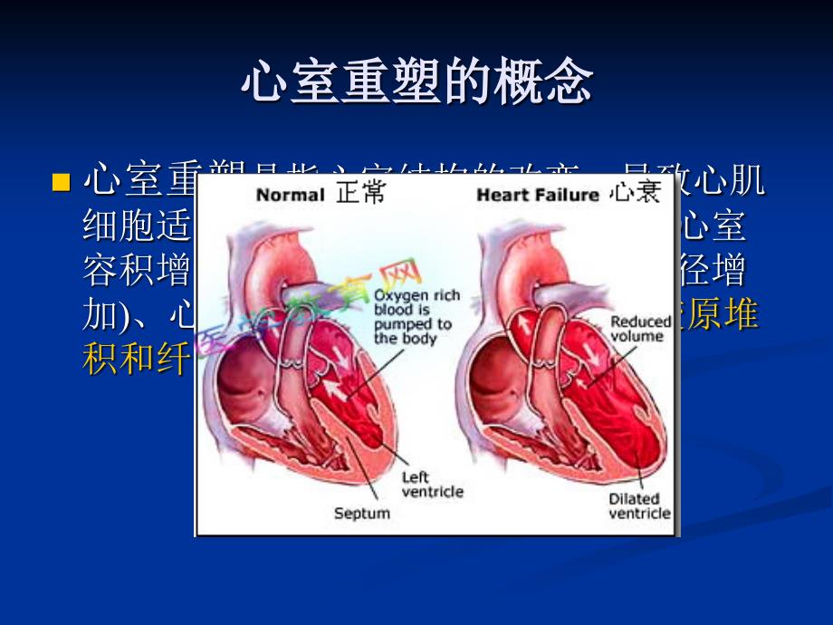 基质金属蛋白酶MMPs与心室重塑的关系及相关治疗_第3页