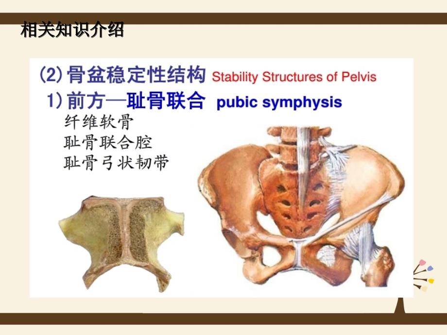 骨盆骨折护理查房83325_第4页