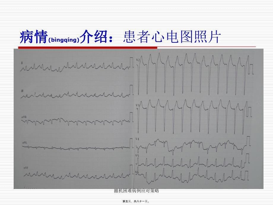 撤机困难病例应对策略课件_第5页