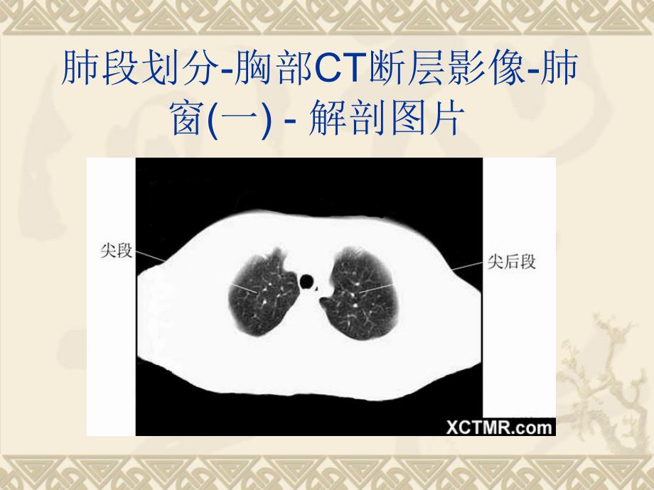 解剖CT详细实用图解_第3页