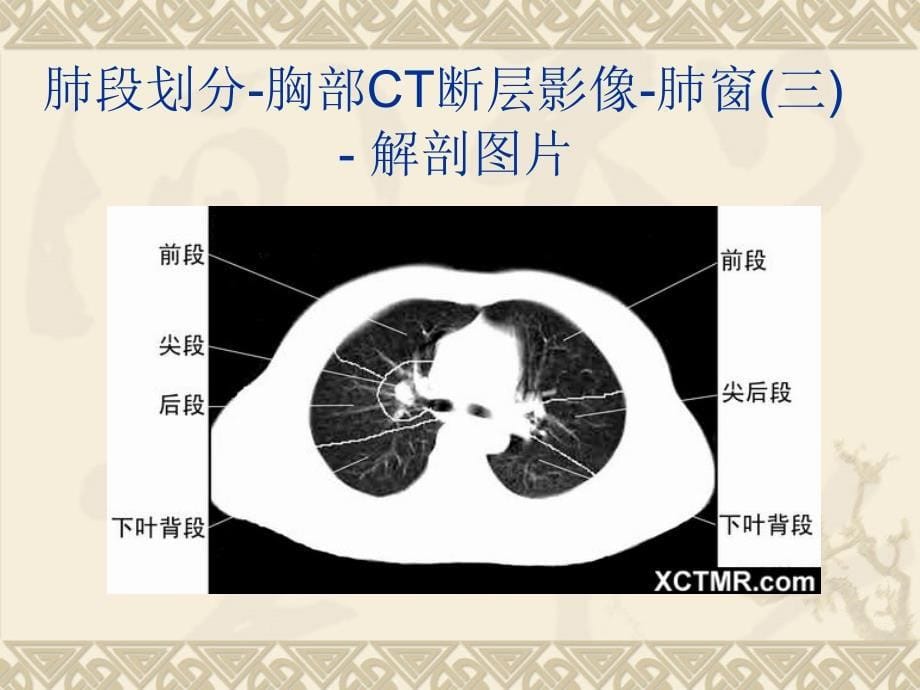 解剖CT详细实用图解_第5页