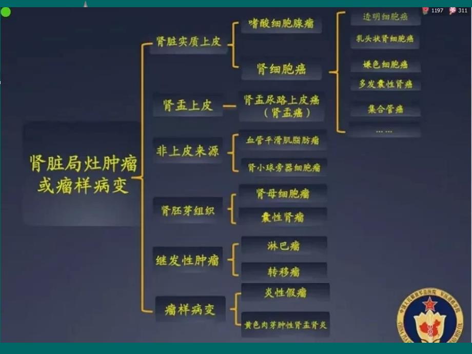 肾细胞癌MRI诊断及鉴别诊断PPT_第2页