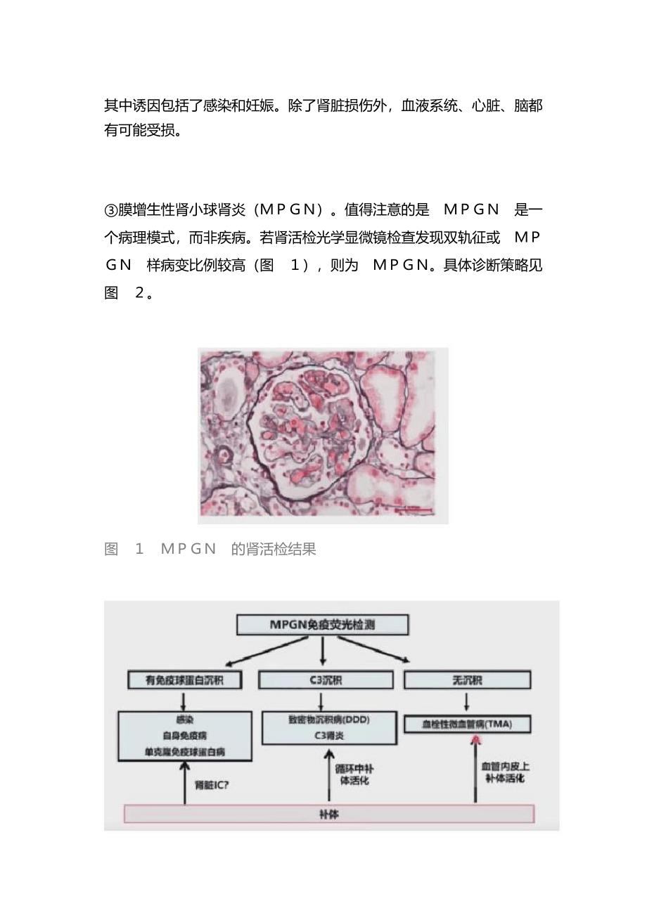 补体与肾脏疾病的研究和诊疗进展(全文)_第4页