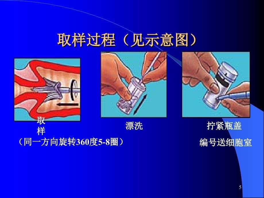 子宫颈病变诊治的总结和建议ppt课件_第5页