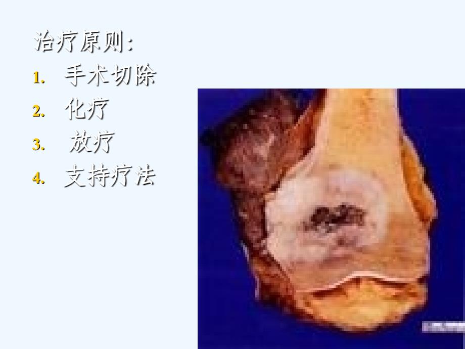 医学知识肿瘤课件_第4页