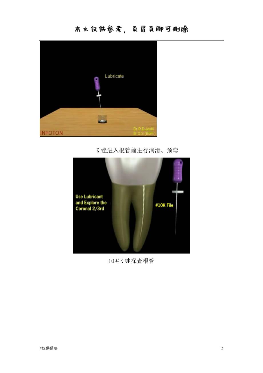 根管预备操作流程（借鉴资料）_第2页