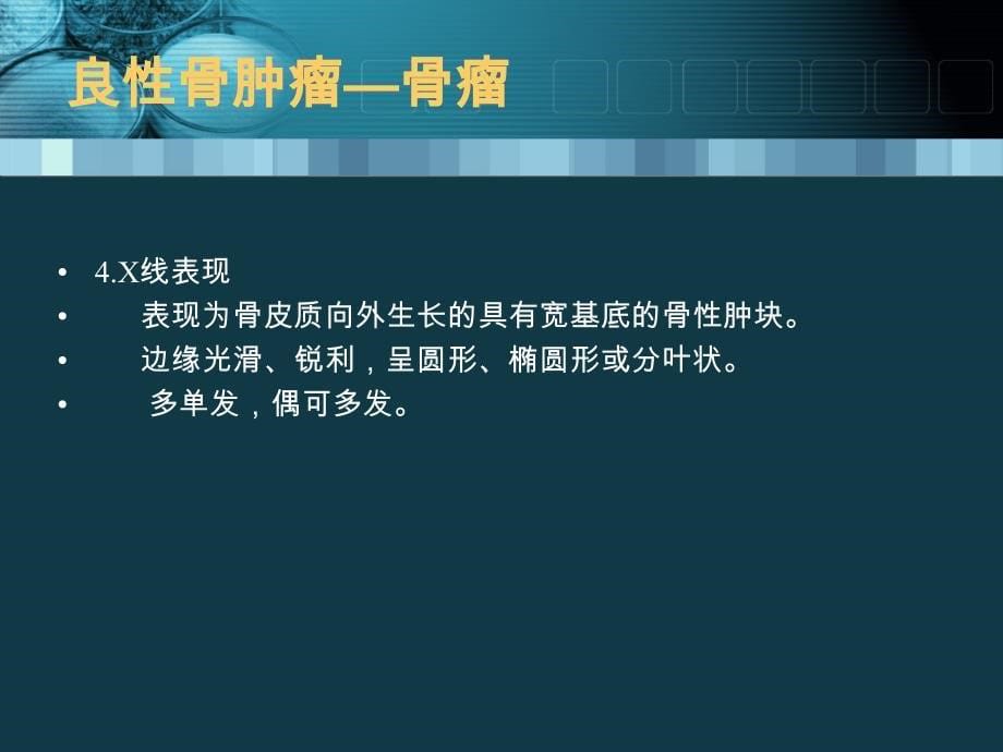 《影像诊断学》教学课件：骨关节疾病诊断课件--良性骨肿瘤_第5页