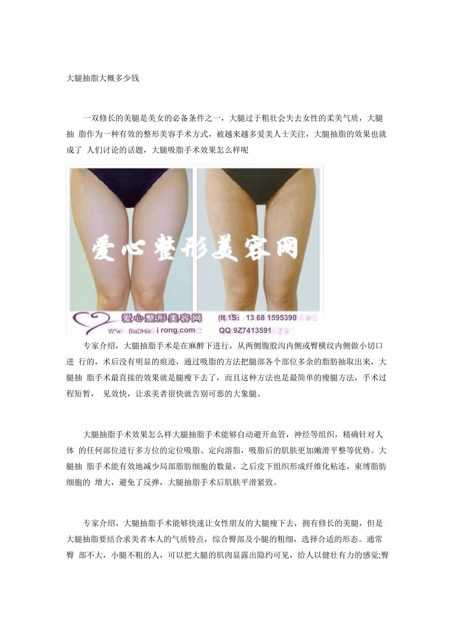 大腿抽脂大概多少钱_第1页