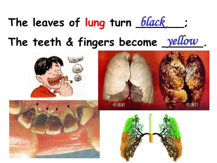 集体备课---新人教选修6Unit3Ahealthylife(Reading)_第4页