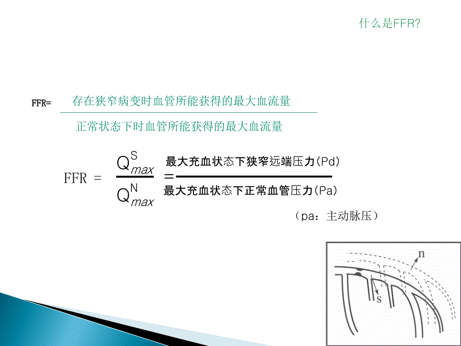 FFR-临床应用知识分享_第2页