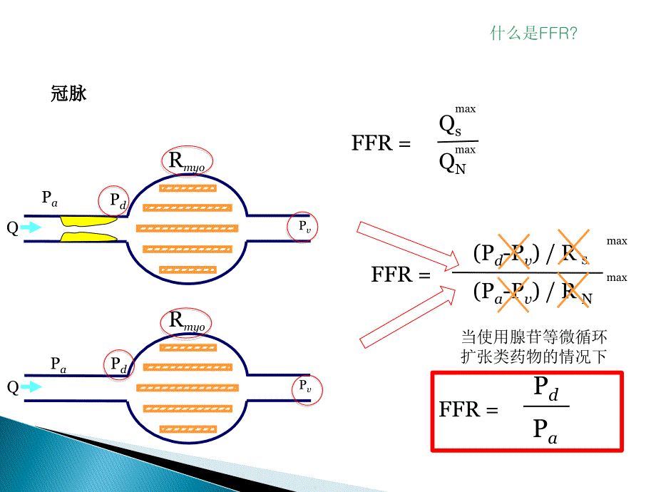 FFR-临床应用知识分享_第3页