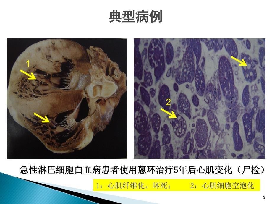 肿瘤治疗原则PPT课件_第5页