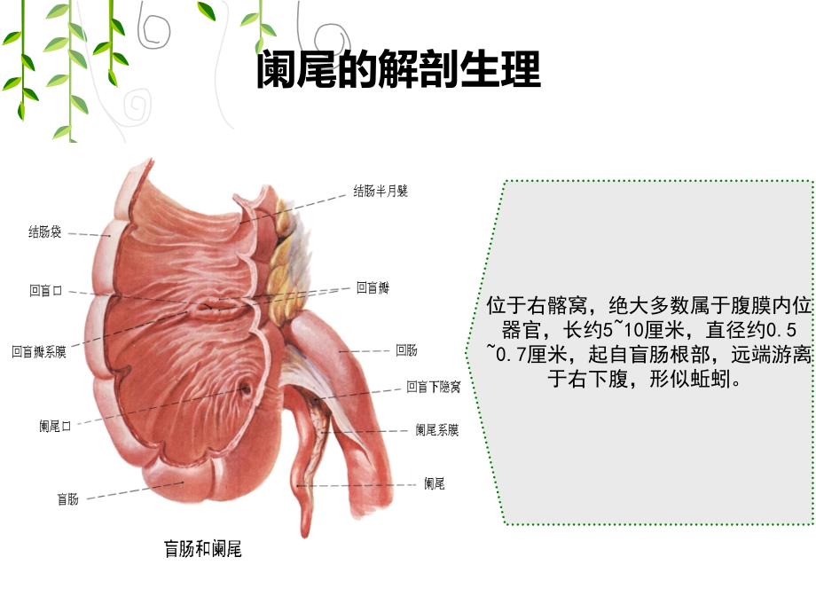 阑尾炎腹腔镜术前术后护理PPT_第3页