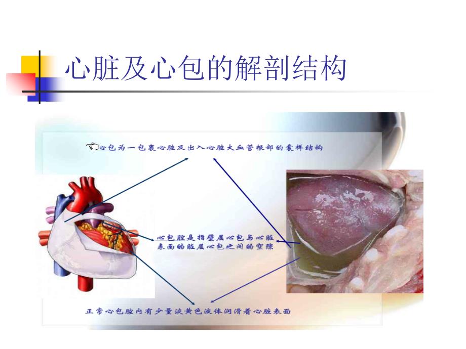 心脏术后合并出血及急性心包填塞的观察及护理_第2页