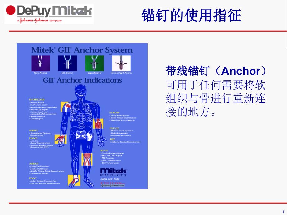 强生带线锚钉ppt参考课件_第4页