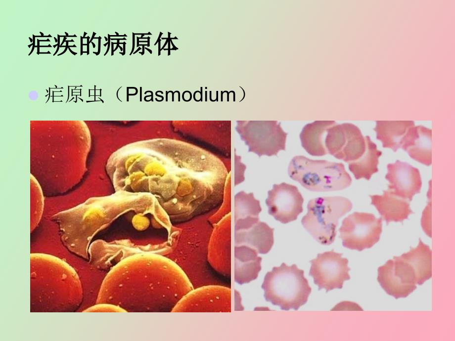 疟疾防治基本知识_第5页