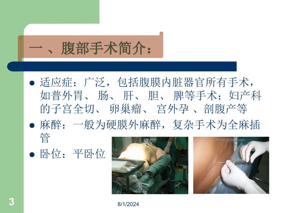 腹部手术配合常规.ppt_第3页